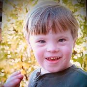George Case Raises Awareness of Down Syndrome With 'Down Right Beautiful'